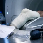 Imagerie par résonance magnétique du genou : ménisque, ligaments et cartilage en IRM